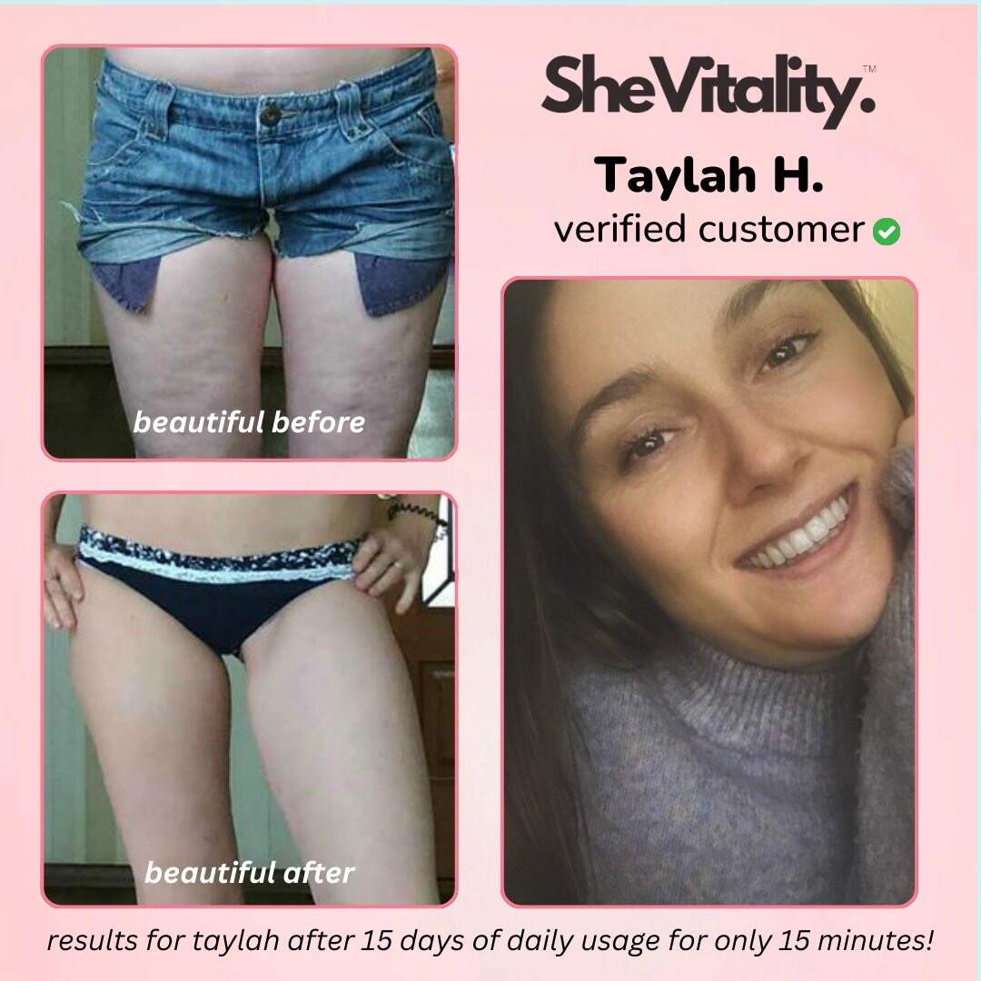 SheVitality™ - Cellulite Relief Kit (50% OFF)