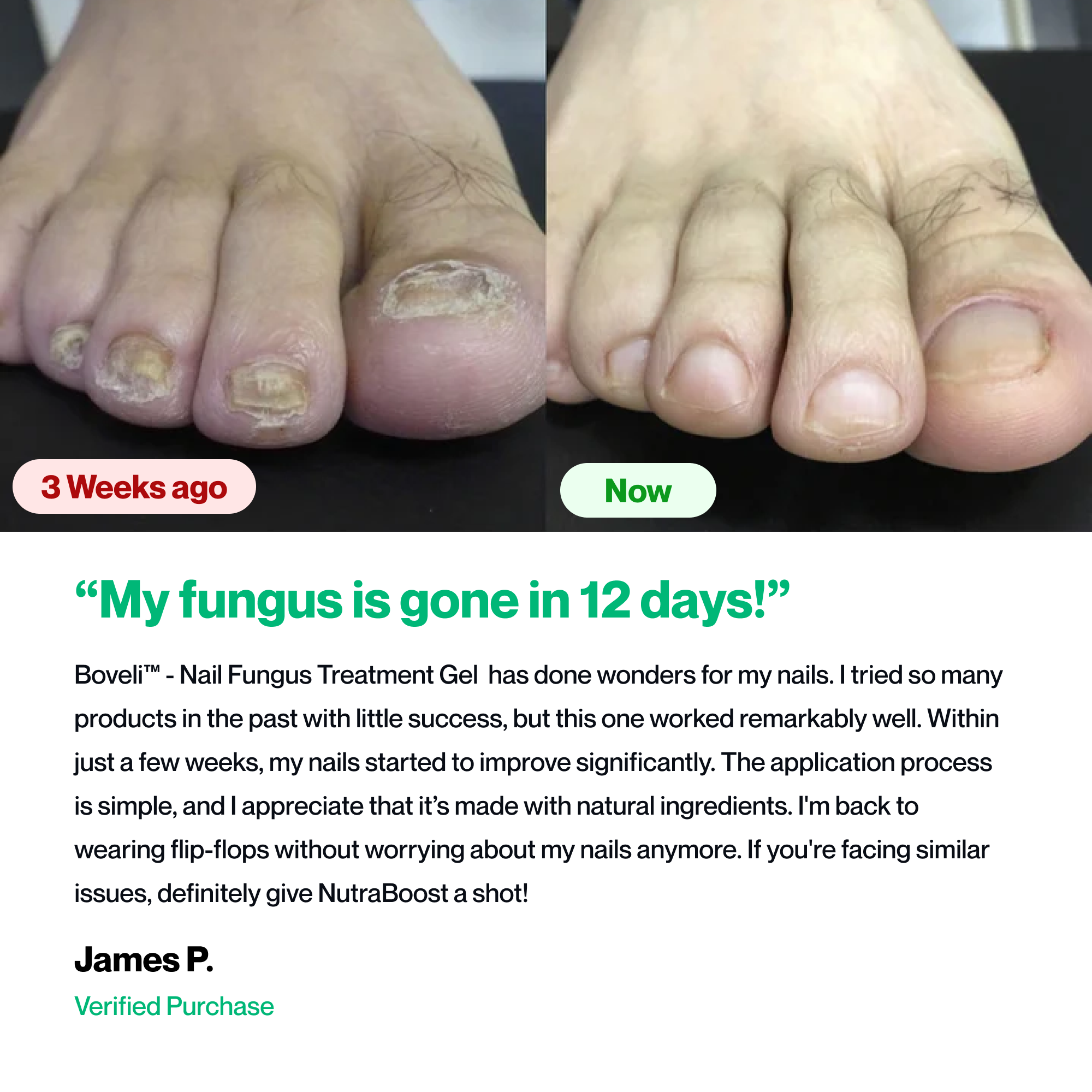 Boveli - Nail Fungus Treatment Gel