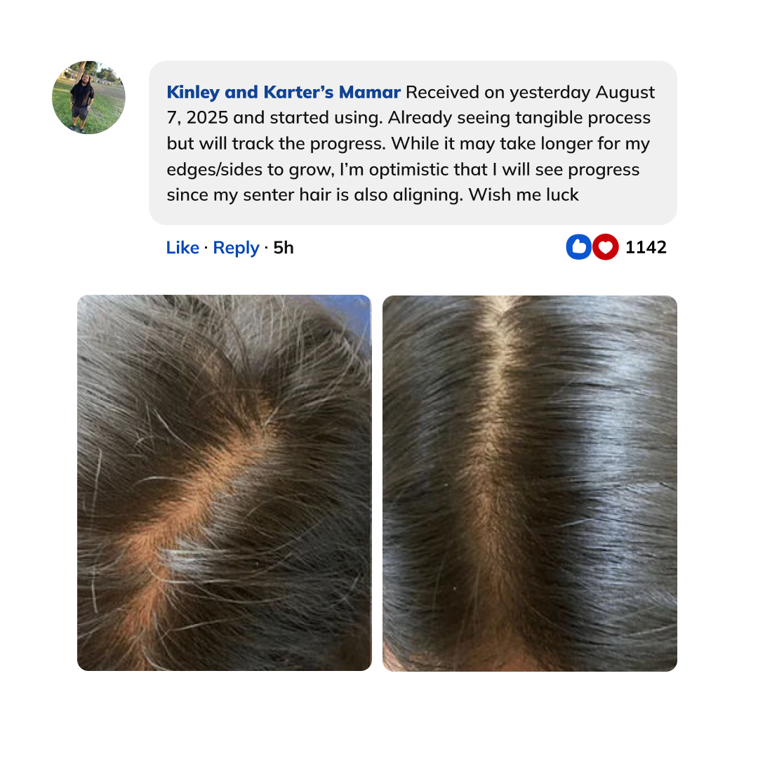 Boveli™ - Advanced Hair Growth Roll-On Serum