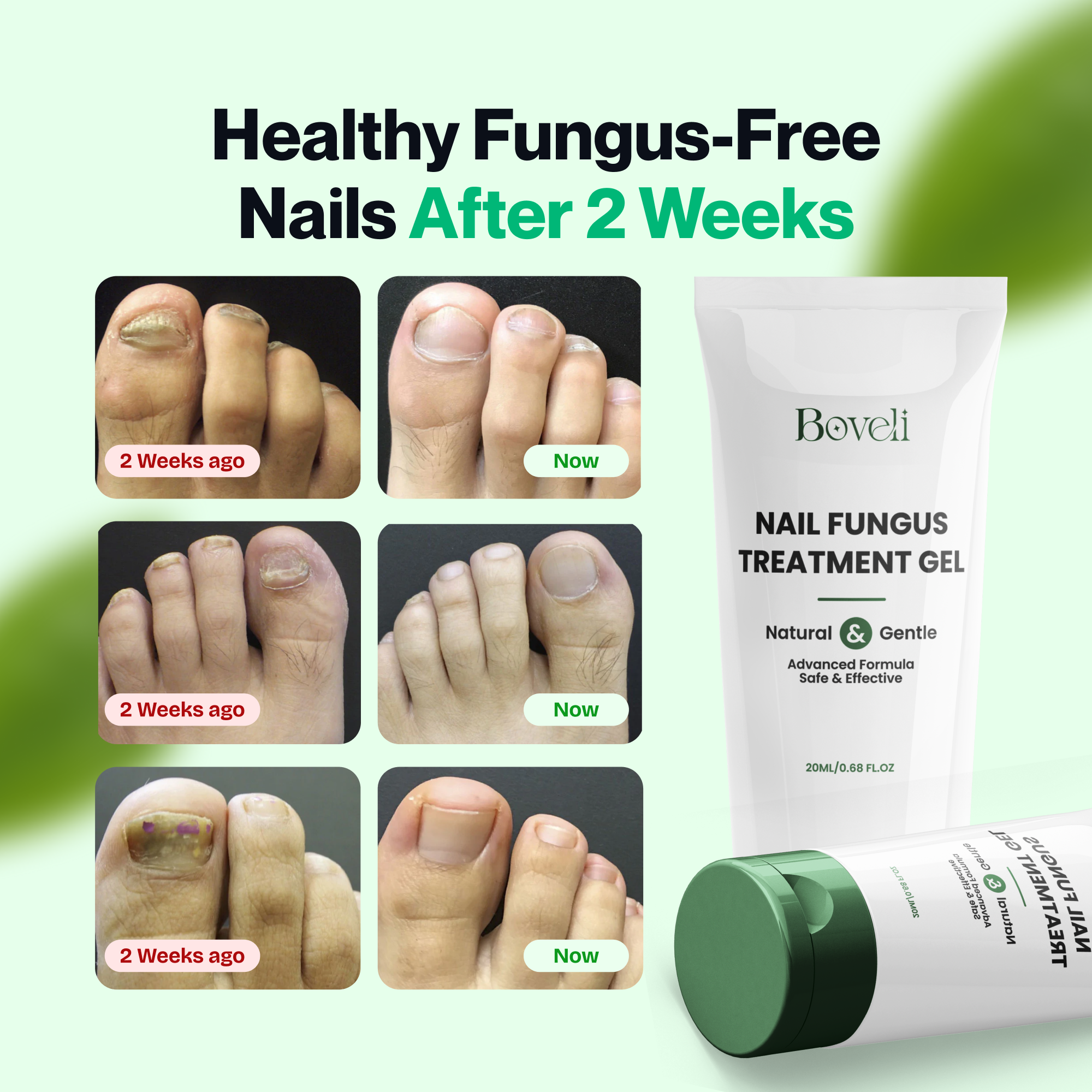 Boveli - Nail Fungus Treatment Gel