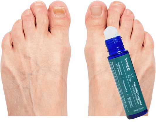 Anti-Fungal Stick (50% OFF)